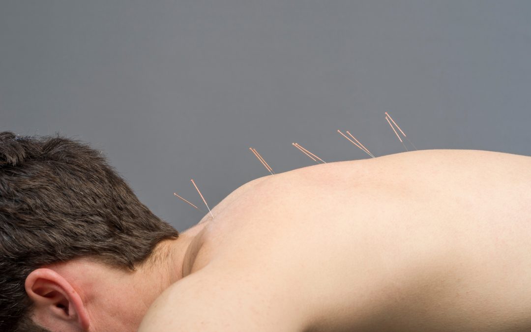 Advance Your Career with Texas Acupuncture Online Courses Today