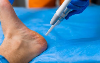 Everyday Solutions for Foot Pain Treatment in Virginia Beach, VA You Can Trust