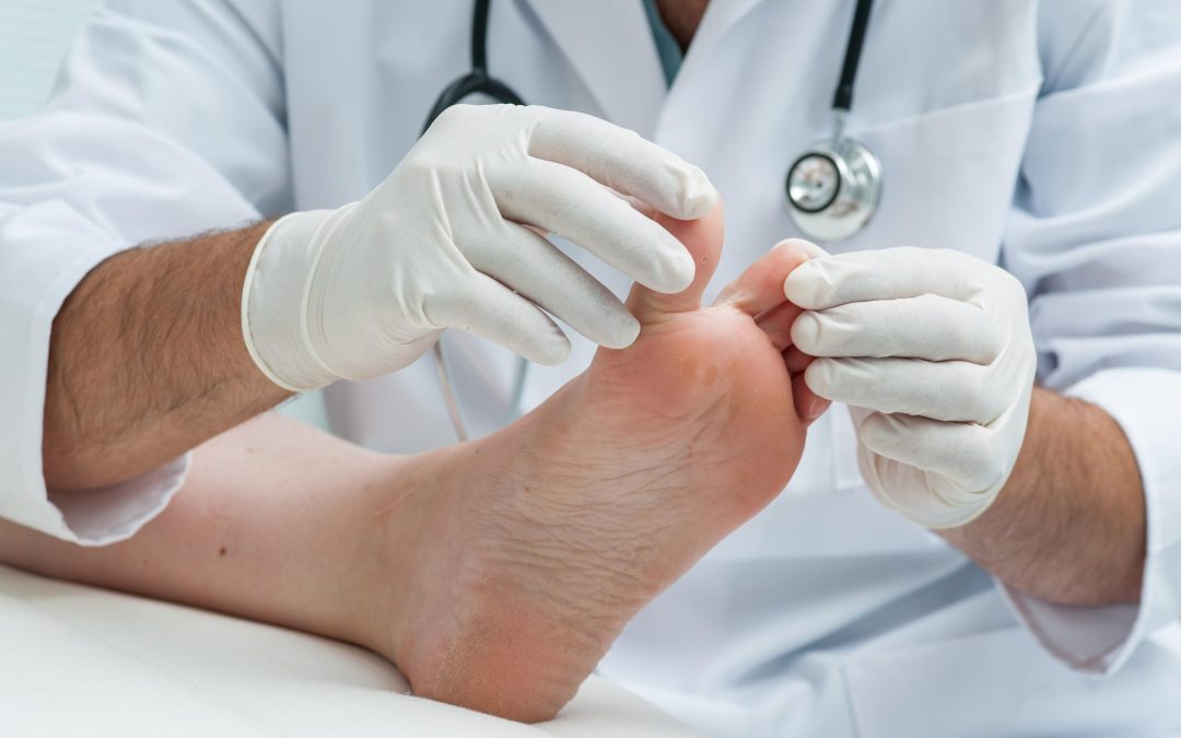 Choosing Effective Ingrown Toenail Treatment in Norfolk, VA for Healthier Feet